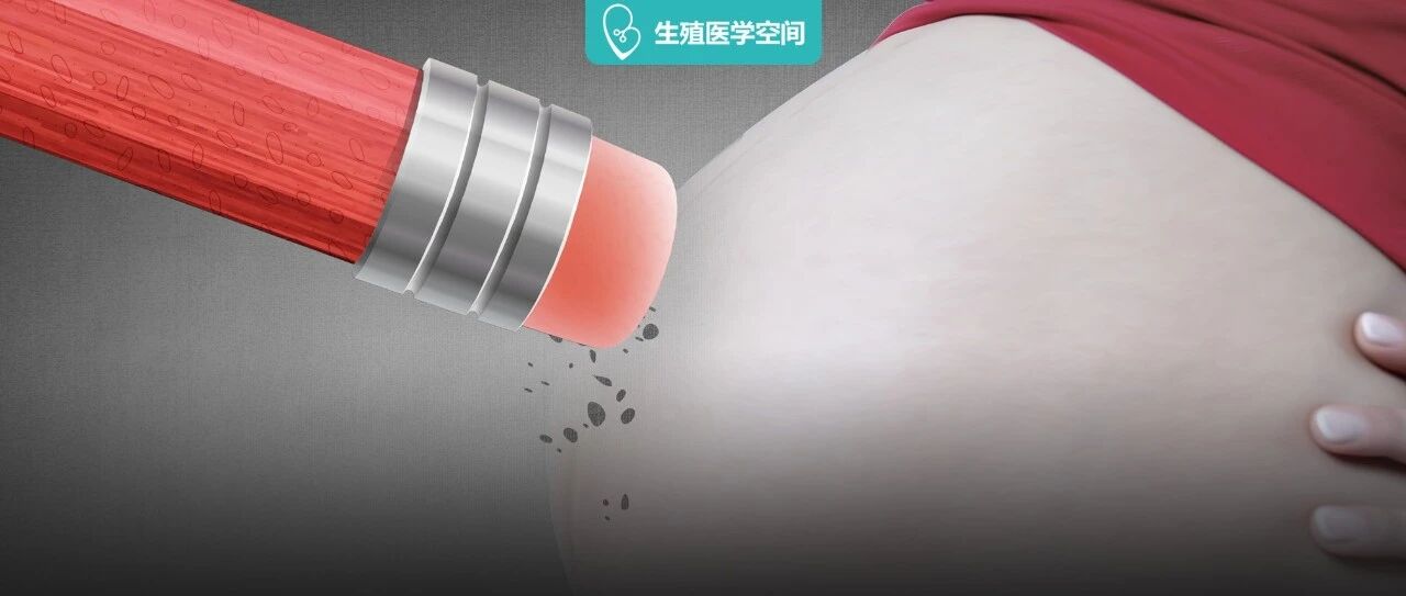 有胎心胎芽还会胎停？这 8 个高风险因素不可不防！