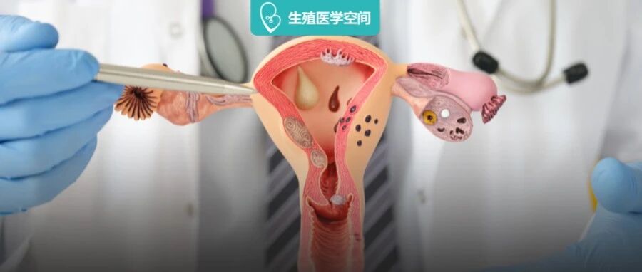 子宫生病的4个信号，很多女生都没当回事