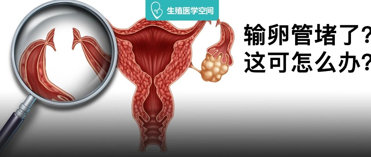 输卵管堵塞的分级、检查及治疗方法！一文全解！