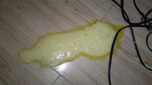 如果呕吐物的颜色是黄黄绿绿的,那代表胆汁已经被吐出来了,这样的情况