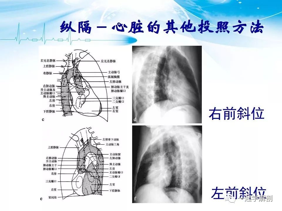 胸部x线（史上最全）