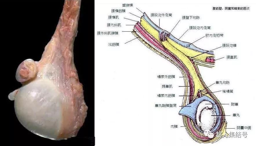 睾丸附件扭转 超人集结号 微信公众号文章阅读 Wemp