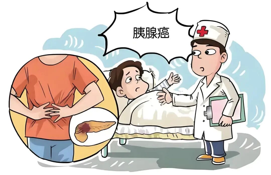 57岁男子不痛不痒查出胰腺癌！医生：忽视了3个身体的早期“暗示”