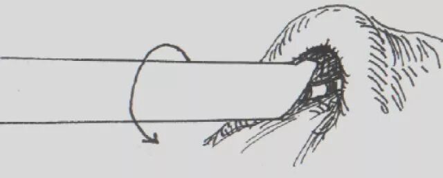 输尿管镜需要哪些导丝手把手教你玩转输尿管镜_https://www.jmylbn.com_新闻资讯_第1张
