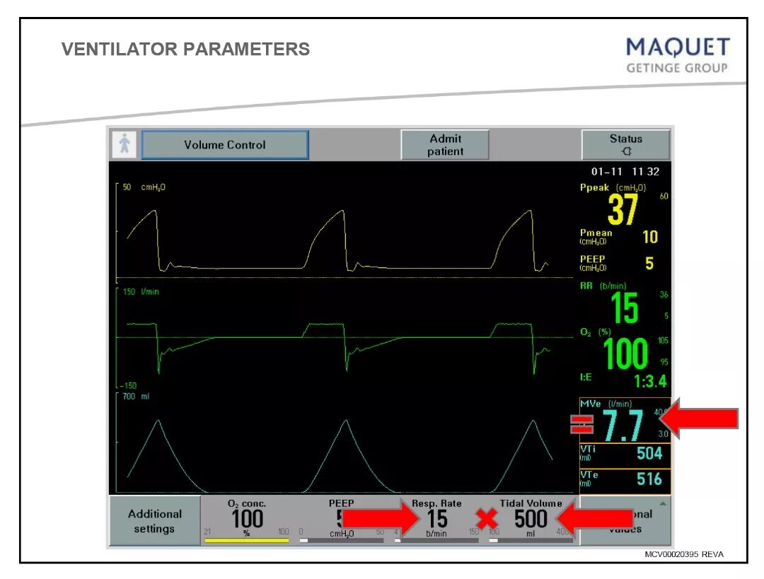 呼吸机压力怎么设置「基础篇」呼吸机模式及参数设置，快速上手！_https://www.jmylbn.com_新闻资讯_第7张
