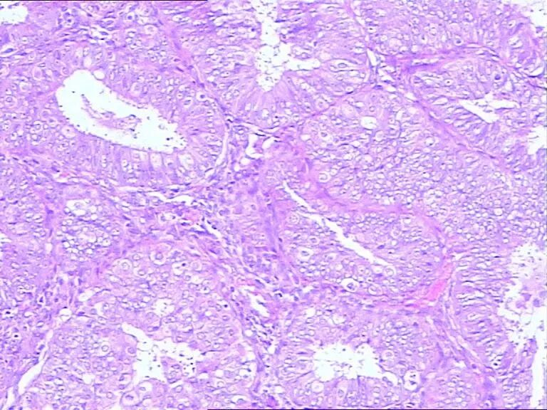 患者家属投诉我，我却成了他的“朋友”
