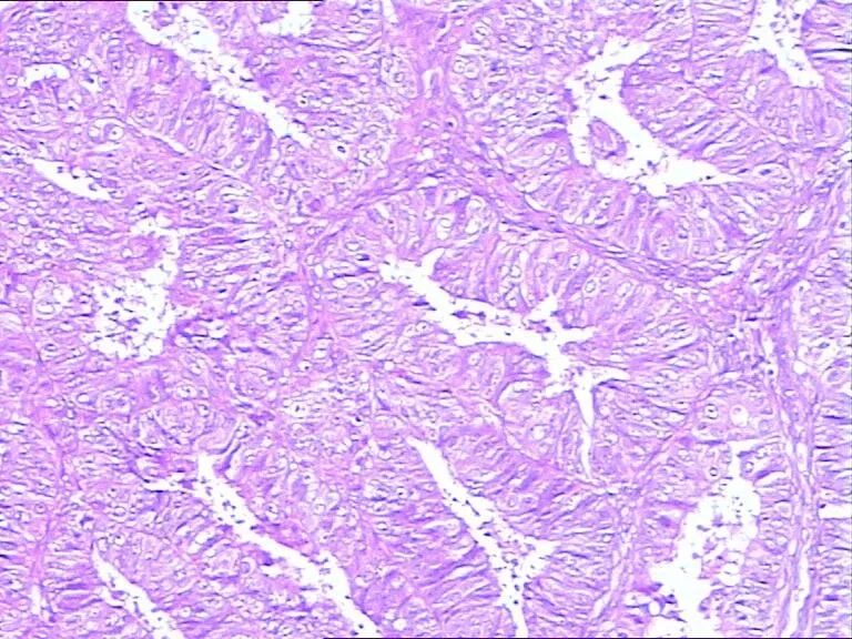 患者家属投诉我，我却成了他的“朋友”