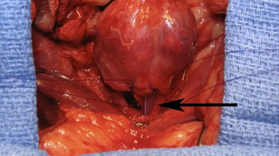 动物拍片腹部怎么摆【译文推荐】小动物腹部x线摄影术，一文教会你如何拍摄出一张高质量的x光片！_https://www.jmylbn.com_新闻资讯_第10张