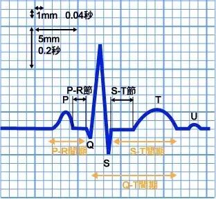 心电图纸的描述有哪些一文全解析 心电图到底该怎么看？_https://www.jmylbn.com_新闻资讯_第8张