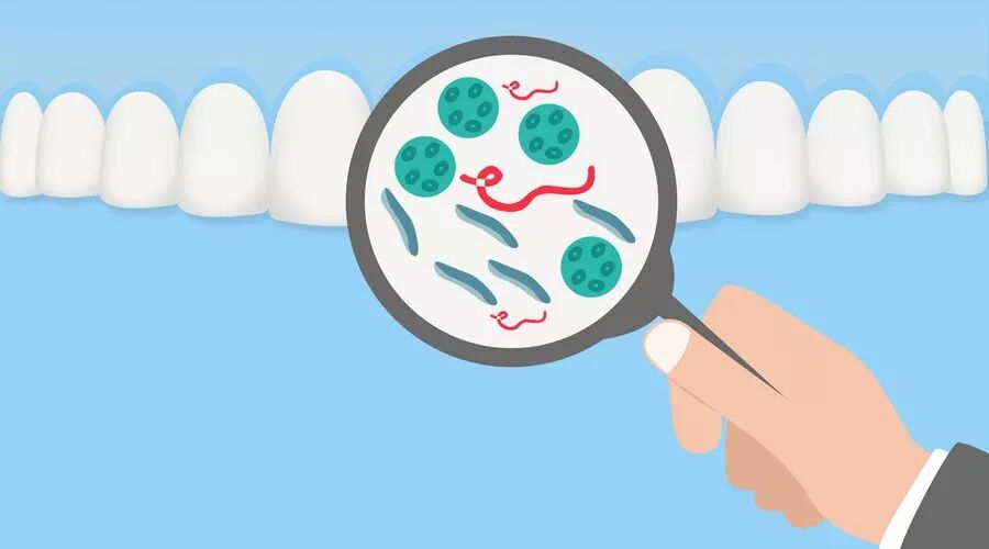 口腔卫生差也是导致口腔癌的元凶