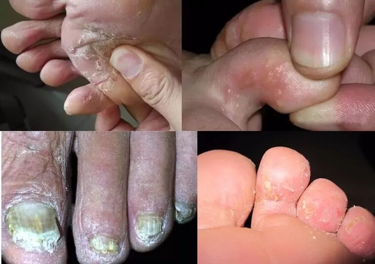 可是当将脚从包裹严实的鞋子里拿出来的时候,除了会带来凉快的感觉