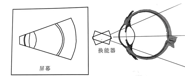 眼科a超怎么做眼部A型超声与眼部B型超声区别（专业篇）_https://www.jmylbn.com_新闻资讯_第5张