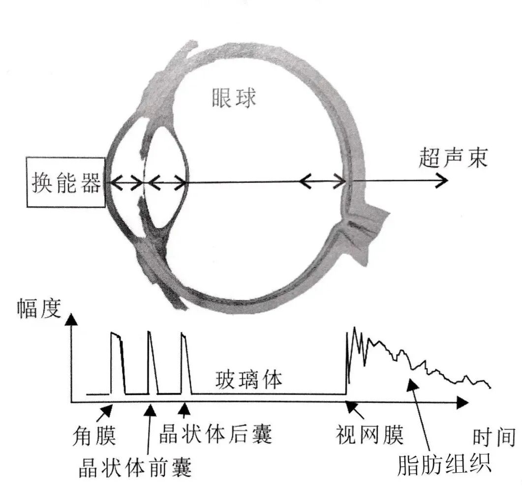 眼科a超怎么做眼部A型超声与眼部B型超声区别（专业篇）_https://www.jmylbn.com_新闻资讯_第3张