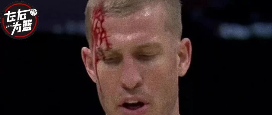 90°严重崴脚+脑袋开瓢！瑟瑟发抖啊...