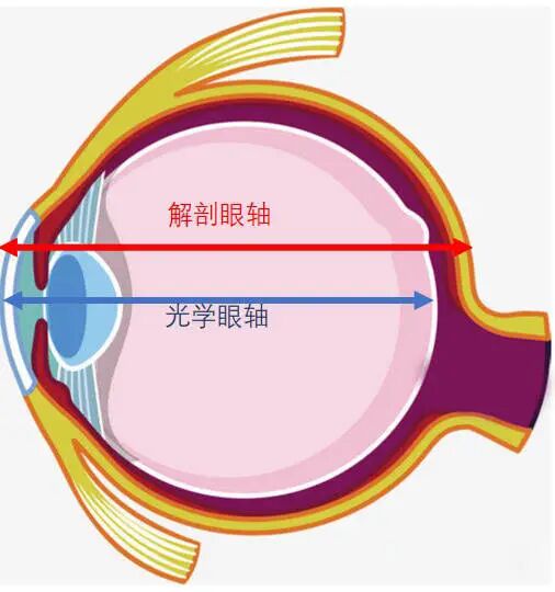 怎么测角膜直径【原创】生物测量参数︱屈光参数的详解_https://www.jmylbn.com_新闻资讯_第4张
