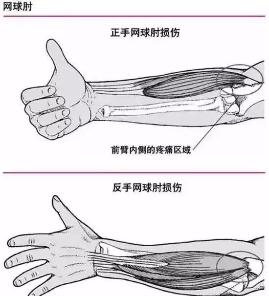 佳釣尼漁具不開玩笑繼續這樣釣魚你的手會廢掉