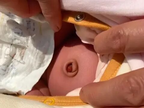 愈脐带怎么用视频宝宝脐部护理，“脐”实不难_https://www.jmylbn.com_新闻资讯_第10张