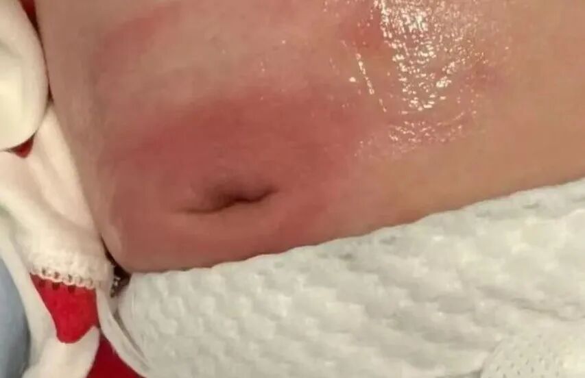 愈脐带怎么用视频宝宝脐部护理，“脐”实不难_https://www.jmylbn.com_新闻资讯_第8张