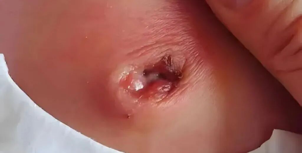 愈脐带怎么用视频宝宝脐部护理，“脐”实不难_https://www.jmylbn.com_新闻资讯_第9张