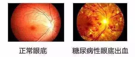 眼底激光机有什么牌子【告别雾里看花】​法国光太眼底激光仪落户宁远爱尔眼科医院！！_https://www.jmylbn.com_新闻资讯_第7张