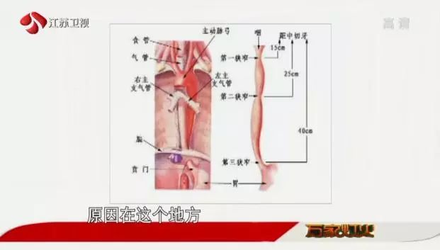 打嗝、反酸、燒心、噯氣怎麼辦？找準病根除頑疾！ 健康 第7張