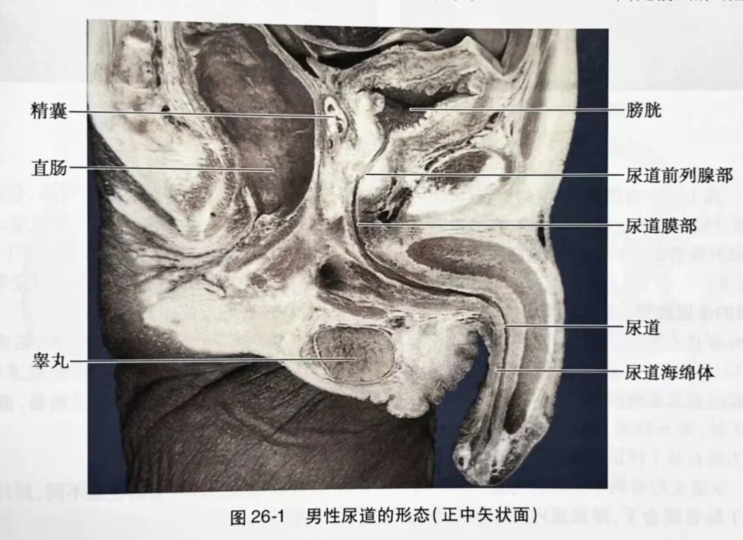 弯头导尿管怎么用尿管插不进去了，是退还是进？_https://www.jmylbn.com_新闻资讯_第3张
