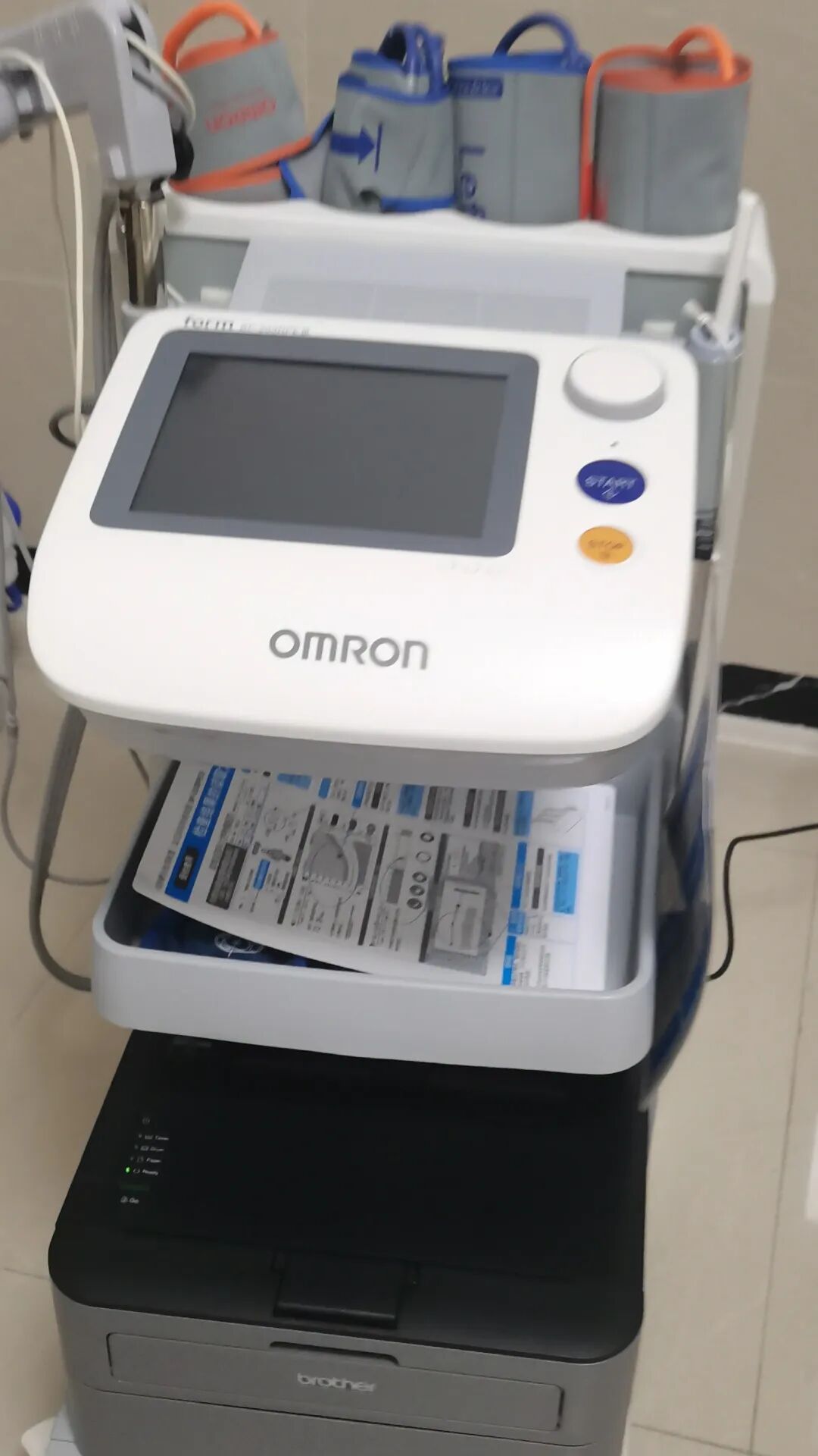 动脉硬化怎么检测血管“照妖镜”——动脉硬化检测_https://www.jmylbn.com_新闻资讯_第4张