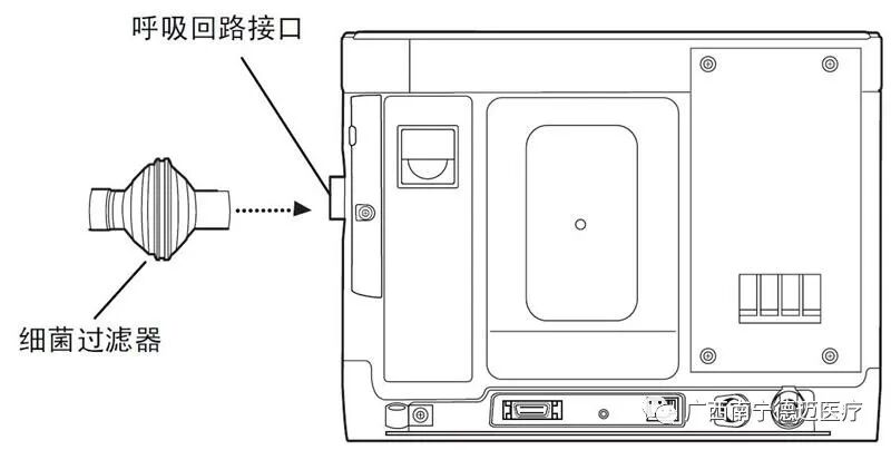 为什么要购买呼吸机为什么要使用一次性细菌过滤器，简单高效的它你真的了解吗？_https://www.jmylbn.com_新闻资讯_第8张