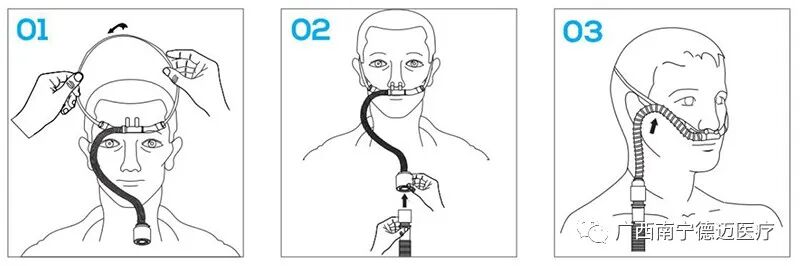 为什么吸鼻氧管通用型高流量鼻氧管，适用于各品牌高流量呼吸湿化治疗仪_https://www.jmylbn.com_新闻资讯_第9张