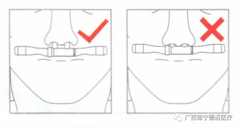 为什么吸鼻氧管通用型高流量鼻氧管，适用于各品牌高流量呼吸湿化治疗仪_https://www.jmylbn.com_新闻资讯_第17张