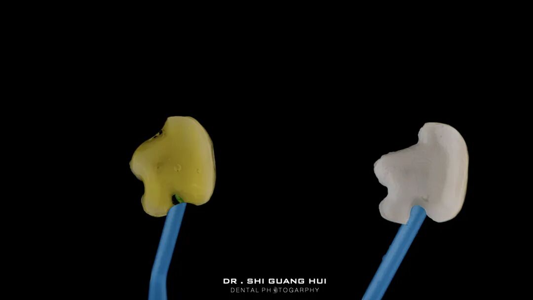 深边缘提升的再思考（龈壁提升的操作细节）