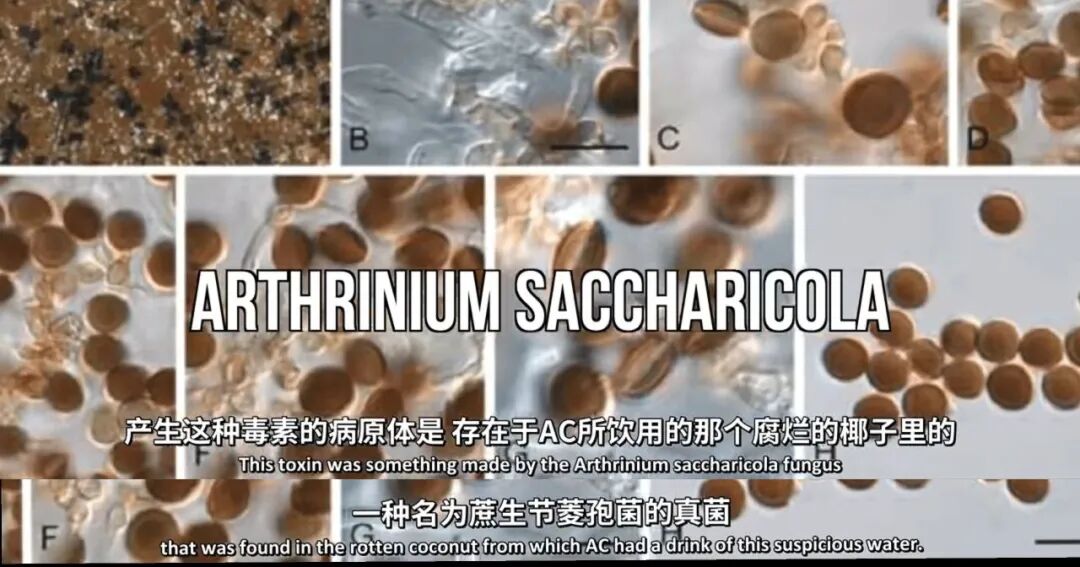 没下巴的人一般都是什么命_下巴命好女人_下巴决定命运