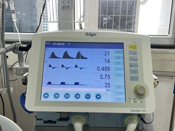 什么时候上呼吸机【新科普】重症医学科仪器设备的“自我介绍”（三）_https://www.jmylbn.com_新闻资讯_第7张