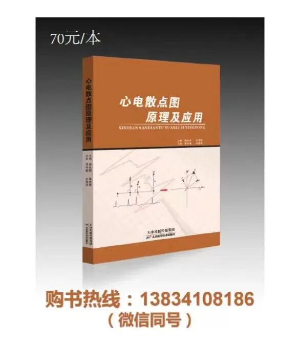 六导心电图怎么用景永明老师：心电图aVR导联在额面六轴系统中的地位与作用_https://www.jmylbn.com_新闻资讯_第3张