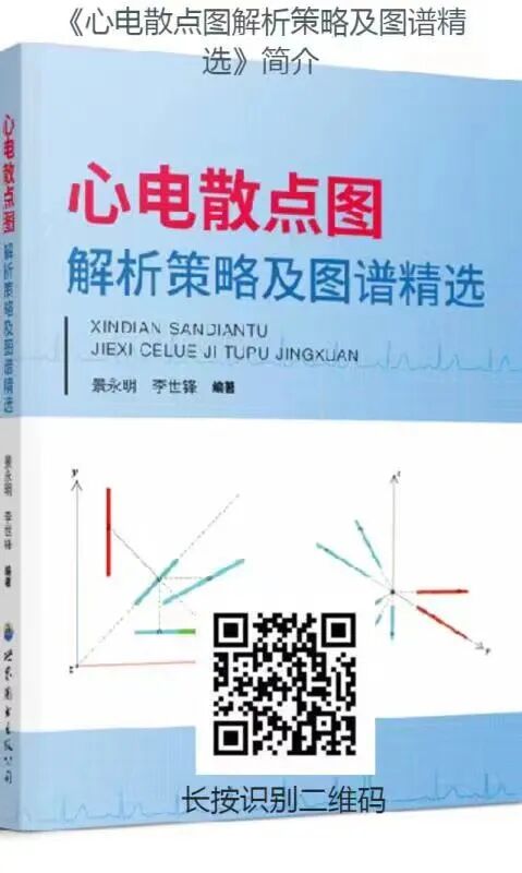 六导心电图怎么用景永明老师：心电图aVR导联在额面六轴系统中的地位与作用_https://www.jmylbn.com_新闻资讯_第4张