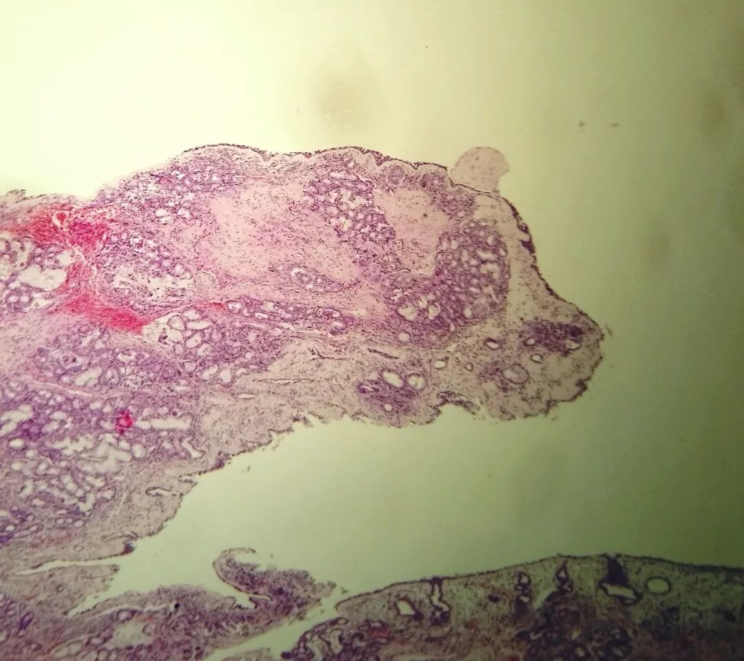 显微镜下看人体组织长啥样:乳腺细胞中,居然有一颗爱心_我的网站