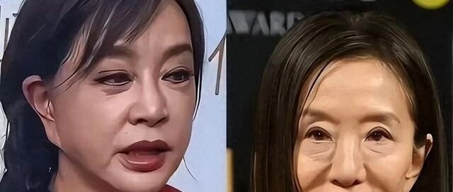 金巧巧整容之后脸面有点怪怪的,以前多漂亮,干嘛要整成这样