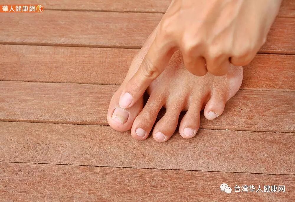 指甲颜色偏黑紫 吴明珠 这些疾病来找麻烦 喝美甲茶指甲不断裂 台湾华人健康网 微信公众号文章阅读 Wemp