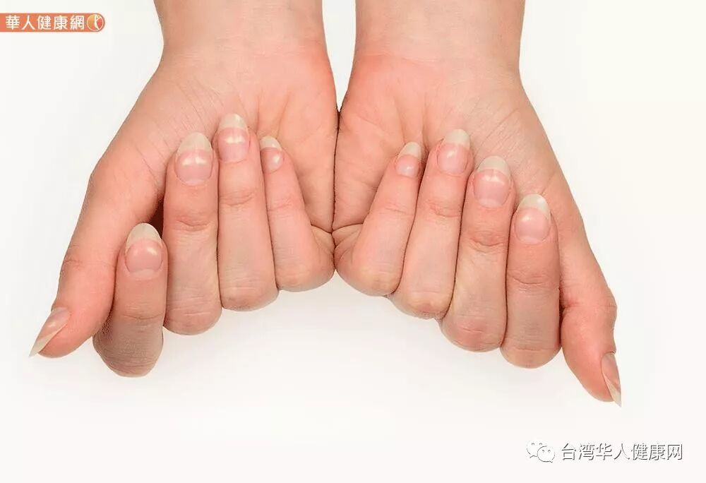 指甲颜色偏黑紫 吴明珠 这些疾病来找麻烦 喝美甲茶指甲不断裂 台湾华人健康网 微信公众号文章阅读 Wemp