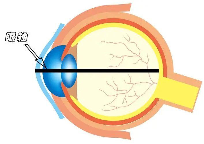 眼科生物测量仪怎么看认识眼生物测量仪_https://www.jmylbn.com_新闻资讯_第6张