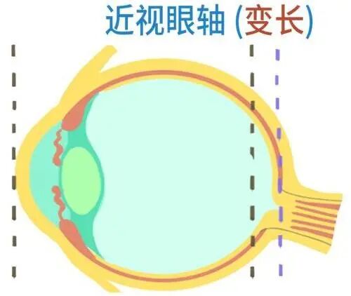眼科生物测量仪怎么看认识眼生物测量仪_https://www.jmylbn.com_新闻资讯_第11张