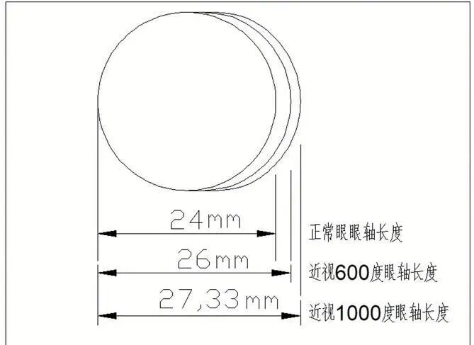 怎么测角膜直径【监测近视“神器”】全面认识眼生物测量仪！_https://www.jmylbn.com_新闻资讯_第5张