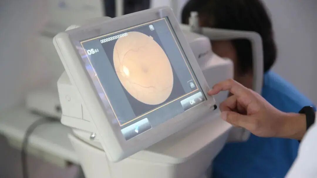 眼底照相能检查出什么教你如何看懂眼底检查_https://www.jmylbn.com_新闻资讯_第4张