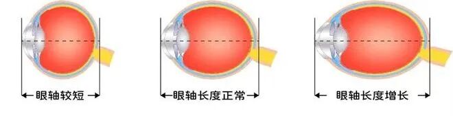 红光仪是什么【视光之窗】183期：近视红光治疗仪（哺光仪）的“洗牌”之路_https://www.jmylbn.com_新闻资讯_第8张