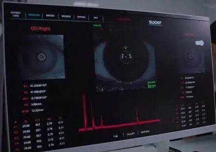 眼科生物测量仪怎么看眼生物测量仪数据解析_https://www.jmylbn.com_新闻资讯_第2张