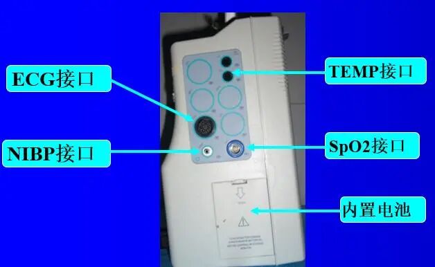心电监护仪怎么看图解心电监护的观察及使用方法_https://www.jmylbn.com_新闻资讯_第10张
