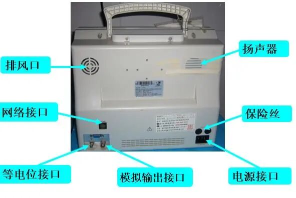 心电监护仪怎么看图解心电监护的观察及使用方法_https://www.jmylbn.com_新闻资讯_第12张