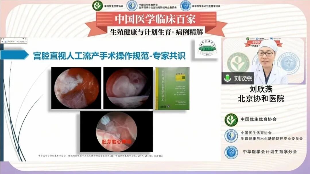 人流吸引管怎么选择病例分享｜早孕合并阴道横隔 行人流术如何保护生育力_https://www.jmylbn.com_新闻资讯_第5张