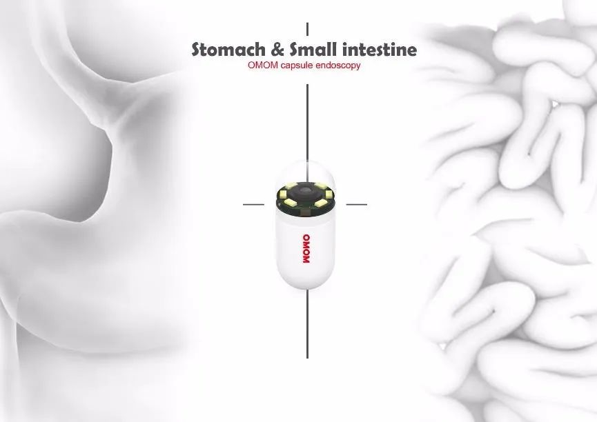 国内首款胃肠一体的磁控胶囊内镜在2020南方消化疾病及消化内镜国际