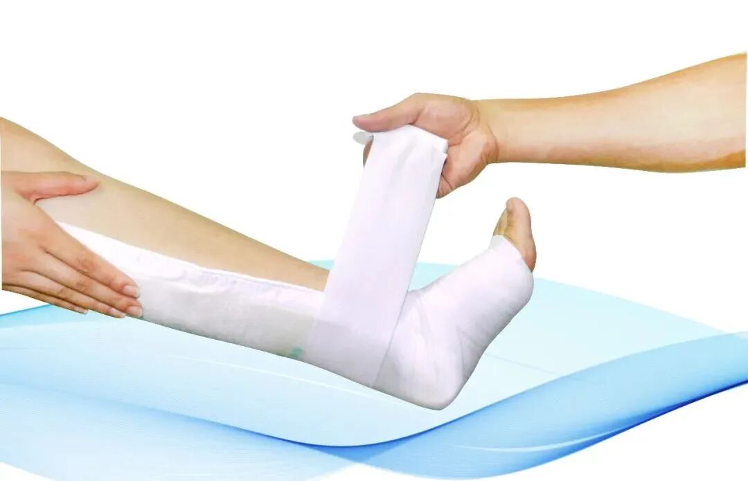 医用夹板怎么软化高分子夹板外固定后出院该注意些什么？_https://www.jmylbn.com_新闻资讯_第2张